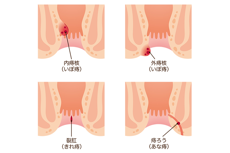 肛門科